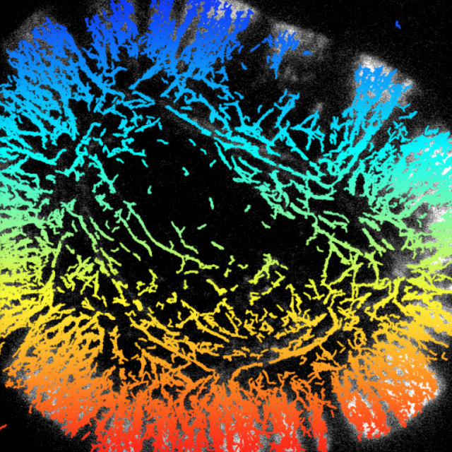 Myosin 6 tracks in a 3T3 fibroblast
